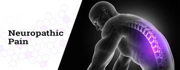 Effective Therapies for Managing Neuropathic Pain