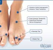 Say Goodbye to Plantar Fasciitis Pain: Effective Solutions for Heel Relief
