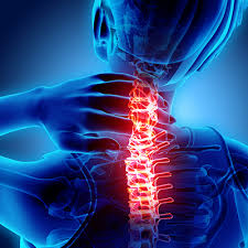 Cervical Traction: How to Alleviate Neck Pain Naturally
