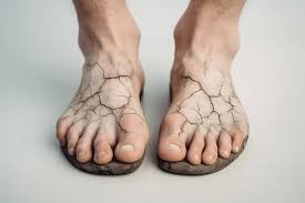 Preventing Diabetic Foot Problems: Essential Foot Care Tips